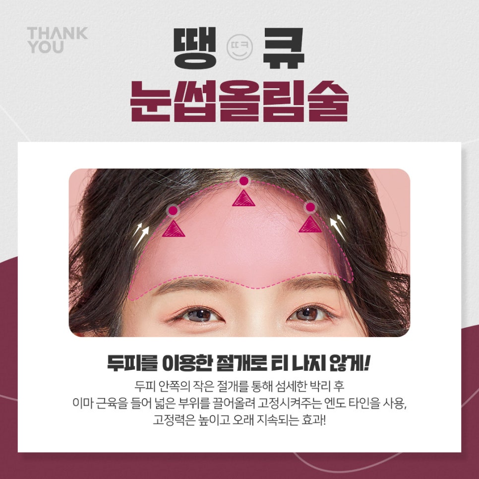 엔도타인 이마거상 찾는다면?시니어&주니어 눈썹올림술 관련 이미지 6