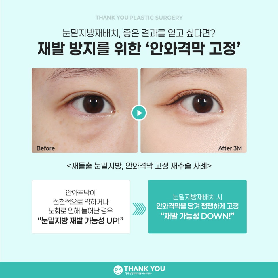 Choosing an Under-Eye Fat Repositioning Clinic: Want Natural, Long-Lasting Results? image 3