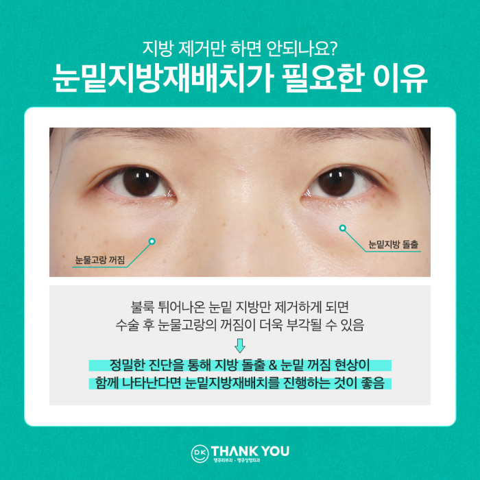 눈밑꺼짐수술? 눈밑지병원에서 내게 딱 맞게! 관련 이미지 4