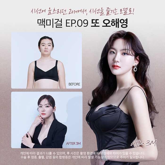 맥미걸 관련 이미지 9