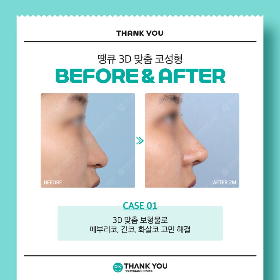 땡큐성형외과 권정우 원장, 해외 성형외과 학회서 코수술 강연 진행 (feat. 3D 맞춤 보형물) 관련 이미지 4