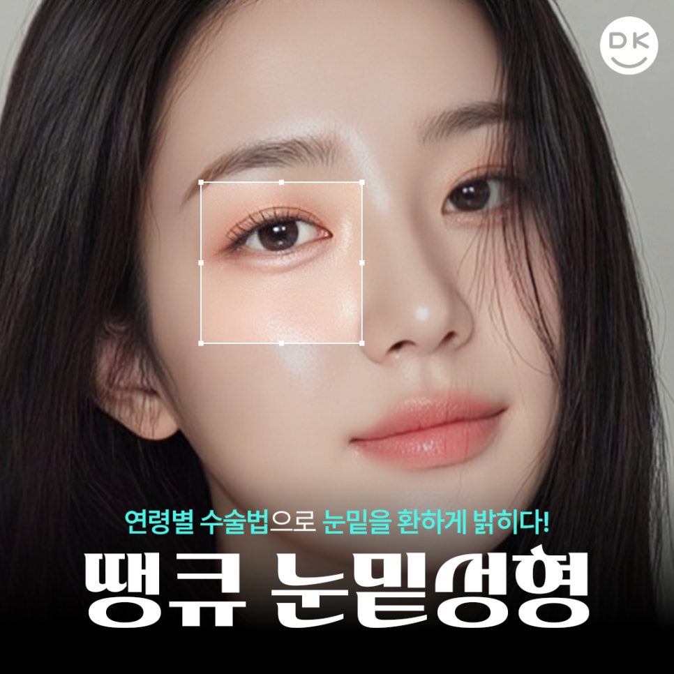 눈밑성형, 연령별로 달라지는 수술법! 무엇이 다를까? 관련 이미지 1