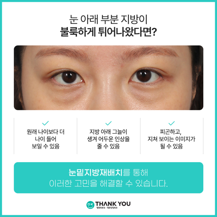 눈밑지병원에서 알려주는 눈밑지방재배치 추천 대상! 관련 이미지 2