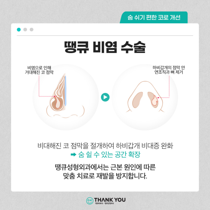 기능코수술병원에서 콧 속 불편함, 외적 스트레스 동시 해소! 관련 이미지 9