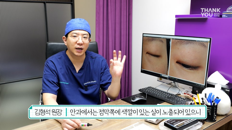 '쌍꺼풀 실 눈찌름'으로 안과? 쌍수실 제거+자연유착 라인 살리는 법 관련 이미지 11