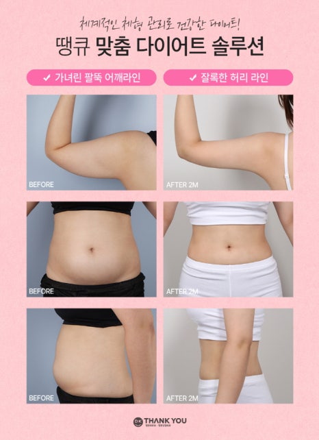 전신지흡 & 체형검사를 통한 성공적인 다이어트! 땡큐 with 맥미걸 관련 이미지 10