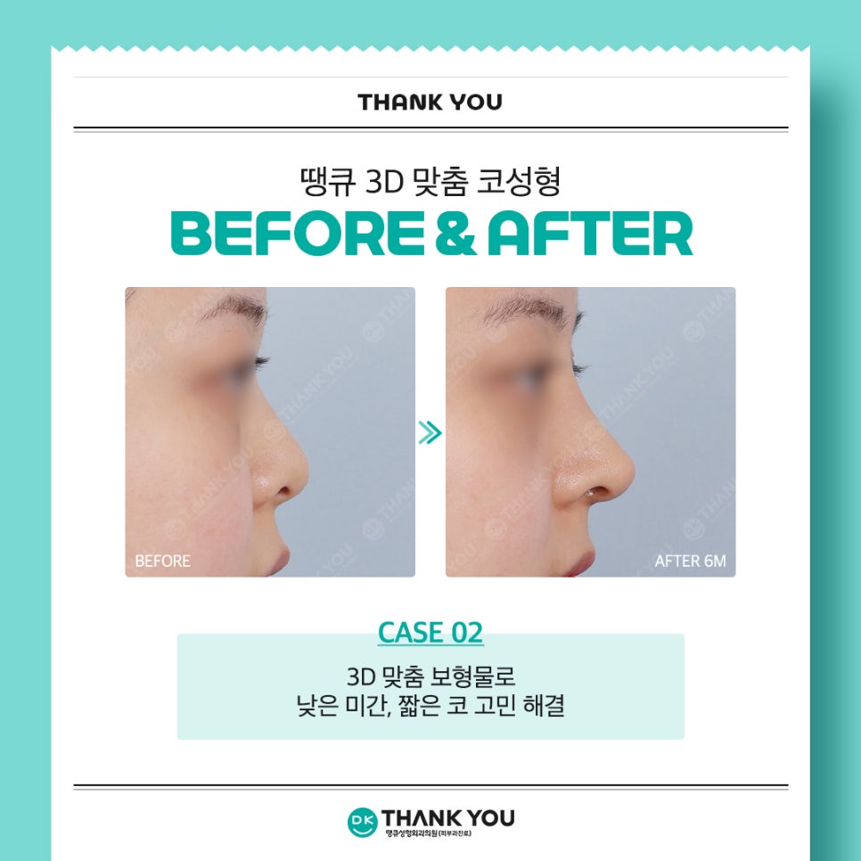 땡큐성형외과 권정우 원장, 해외 성형외과 학회서 코수술 강연 진행 (feat. 3D 맞춤 보형물) 관련 이미지 7