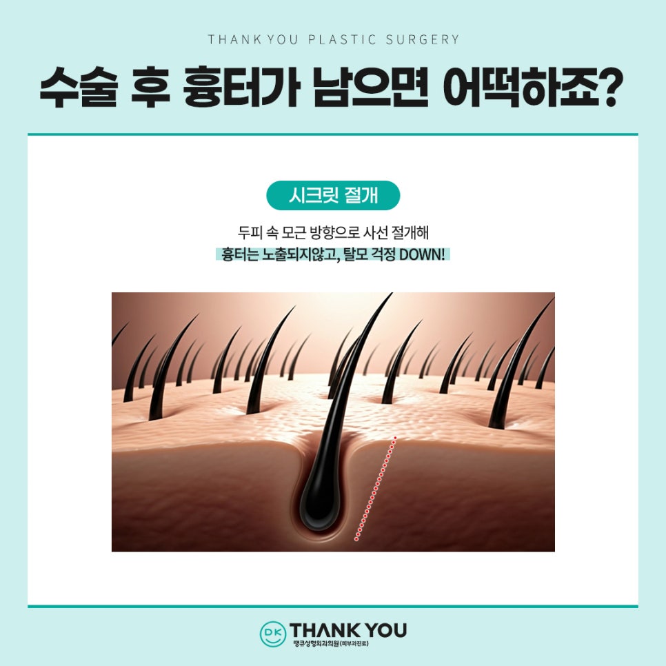 이마거상 흉터, 탈모 걱정된다면? 내시경이마거상술 총정리 관련 이미지 10