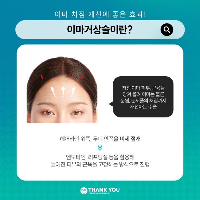 What Are the Effects of a Forehead Lift?[Column by Director Kim Gyu-beom] image 3