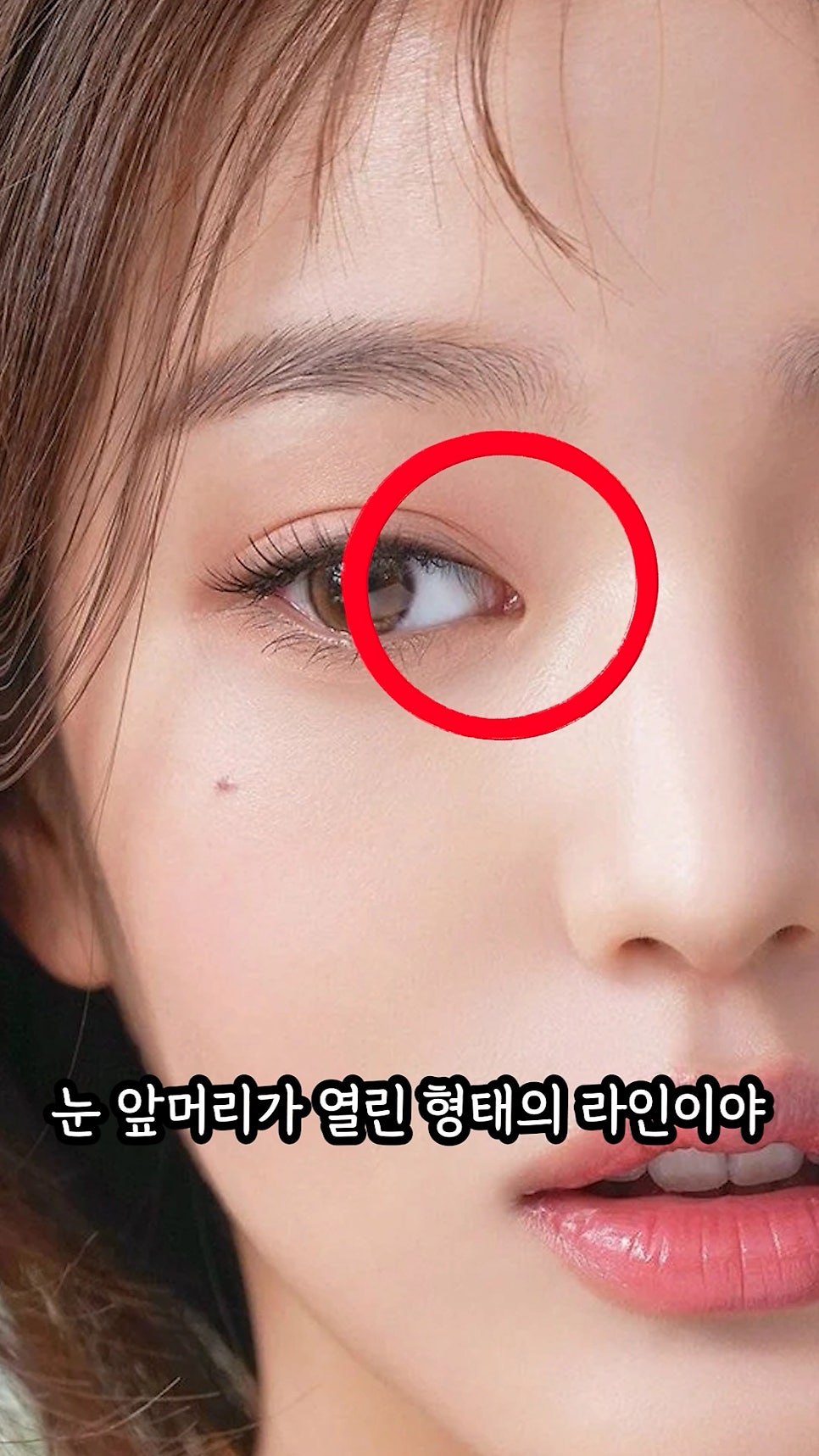 장원영 쌍수, 쌍꺼풀 라인분석 (feat.세미아웃라인) 관련 이미지 4