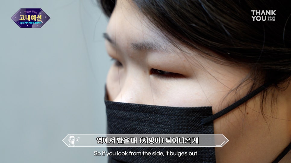 이 나이에?! 20대 이마거상술 (쌍수 후 속쌍 방지🚫) 관련 이미지 12
