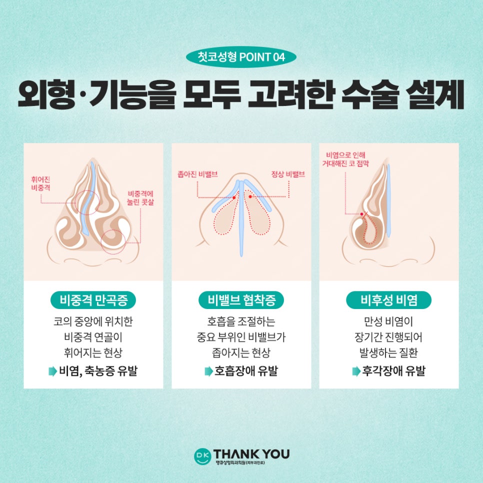 Key Checkpoints You Must Review When Considering Primary Rhinoplasty?! image 6