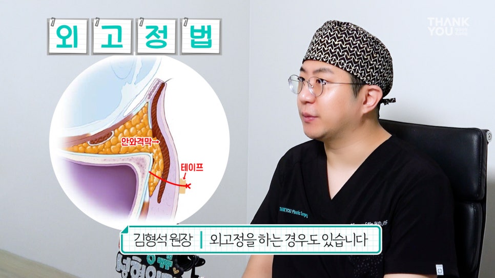 눈밑지 수술후 테이프 꼭 해야할까? 지방재배치 회복기간? 관련 이미지 10