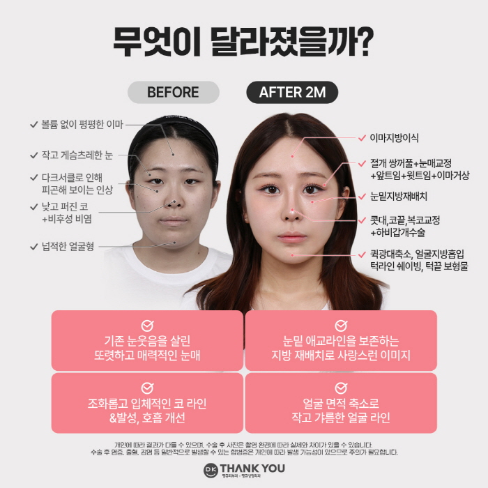 Thank You Plastic Surgery, a Hospital Skilled in Eye Surgery! Providing Customized Solutions for a Make Me Girl Case Study😉 image 8