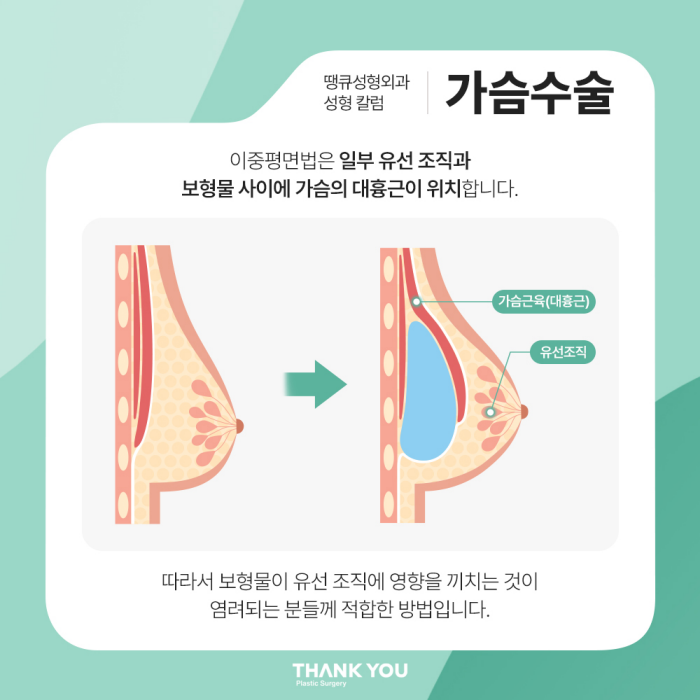 가슴수술전후 궁금증 관련 이미지 3