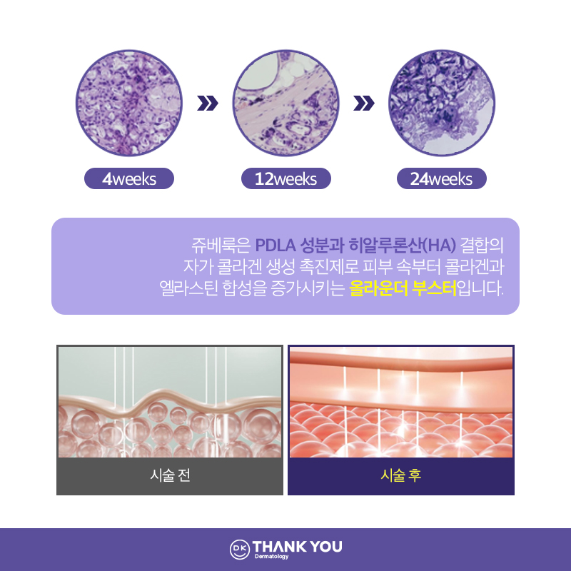 땡큐성형외과 콜라겐 쥬베룩 2종 EVENT ✨ 관련 이미지 3