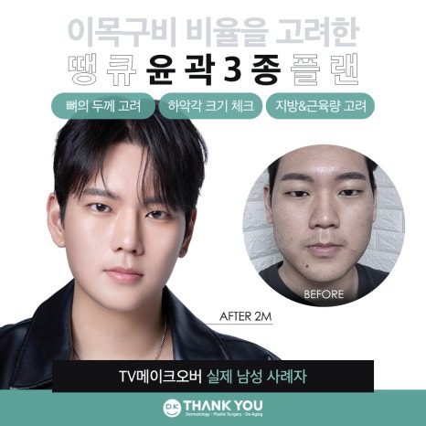 땡큐 윤곽성형 이벤트로 굴곡 없이 작고 매끈한 얼굴 만들기! 관련 이미지 2