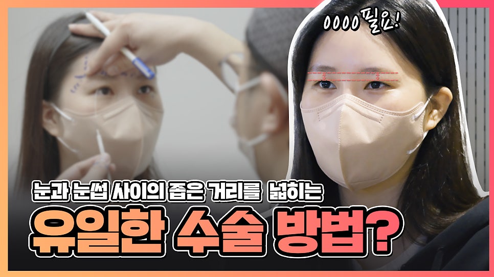 눈과 눈썹 사이 간격 넓히는방법? 이마거상술(눈썹올림술)로 시원하게 관련 이미지 1