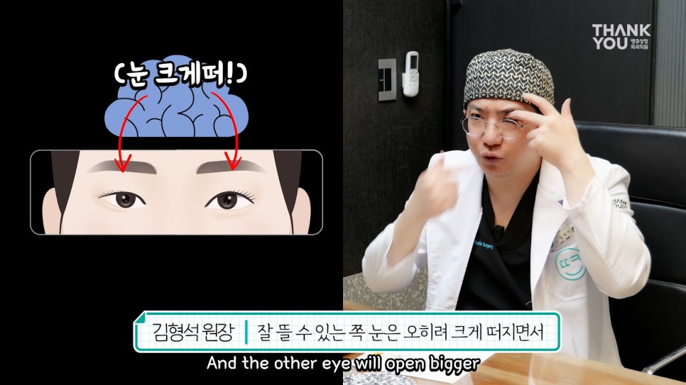 비대칭눈 교정(짝짝이 쌍꺼풀) 헤링의 법칙이란? 관련 이미지 8
