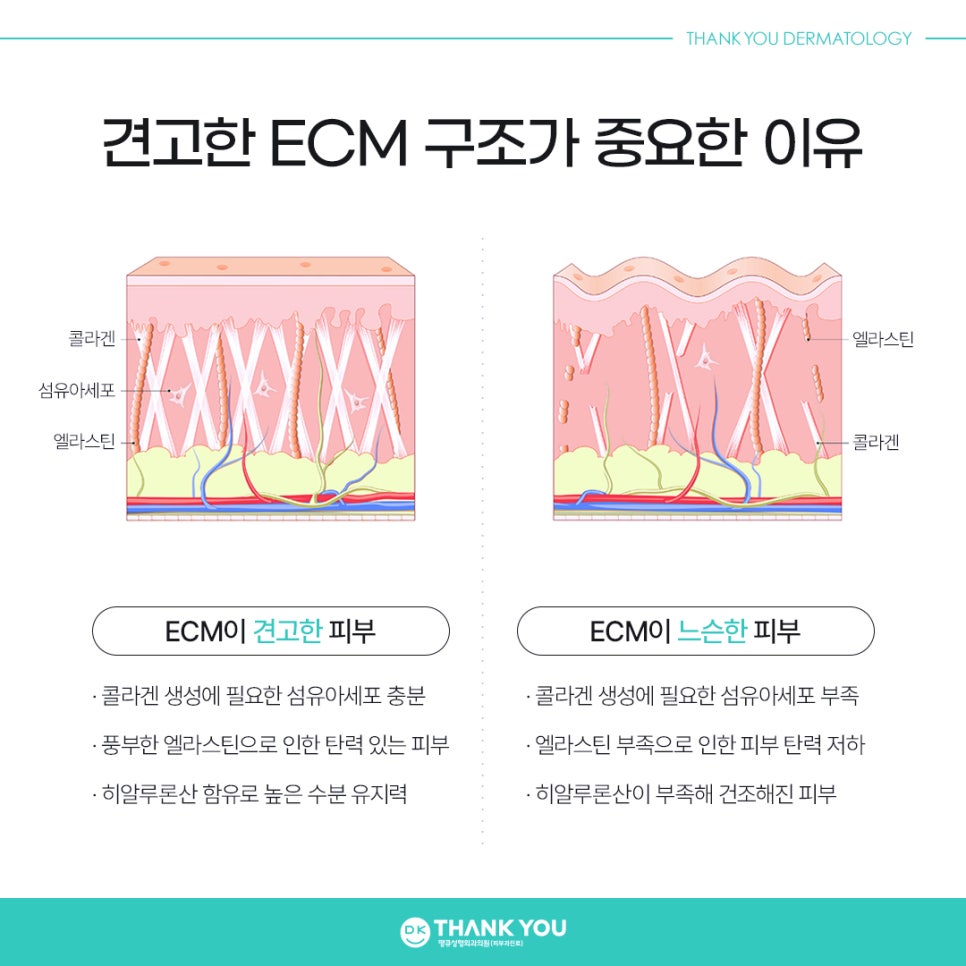 쥬브아셀비용보다 중요한 것은?! 관련 이미지 3
