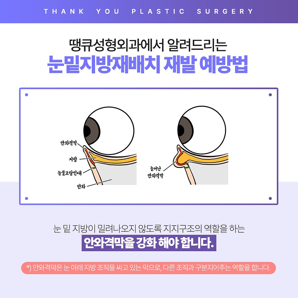 눈밑 불룩? 눈밑지방재배치 수술 후에도 재발할까? 관련 이미지 6