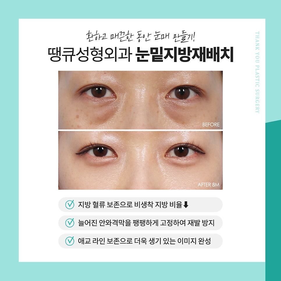 눈밑지 수술 후 얼굴처짐 생길까요? 관련 이미지 5