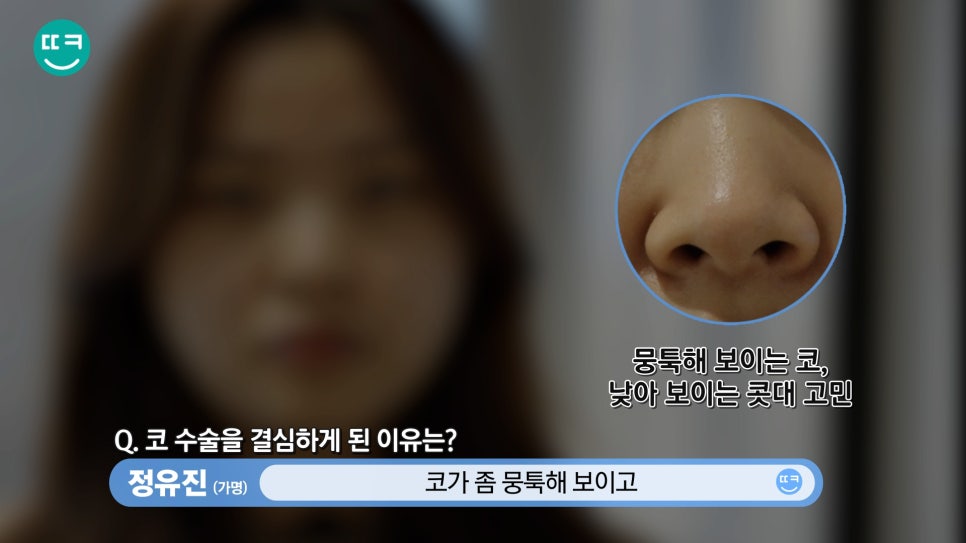 복코 수술&뭉툭한 코 교정👃직원도 믿고 코성형하는 땡큐 관련 이미지 4