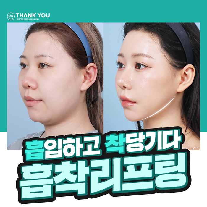 땡큐성형외과 이벤트 : 얼굴윤곽라인 개선엔?! 흡착리프팅 관련 이미지 1