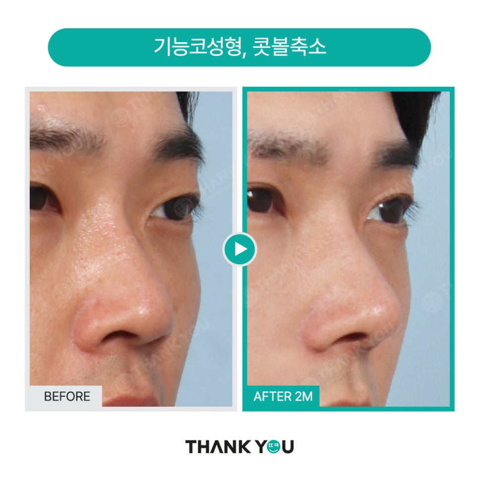 맥미남 배우, 확 달라진 변화? 남자성형외과는 THANK YOU! 관련 이미지 13