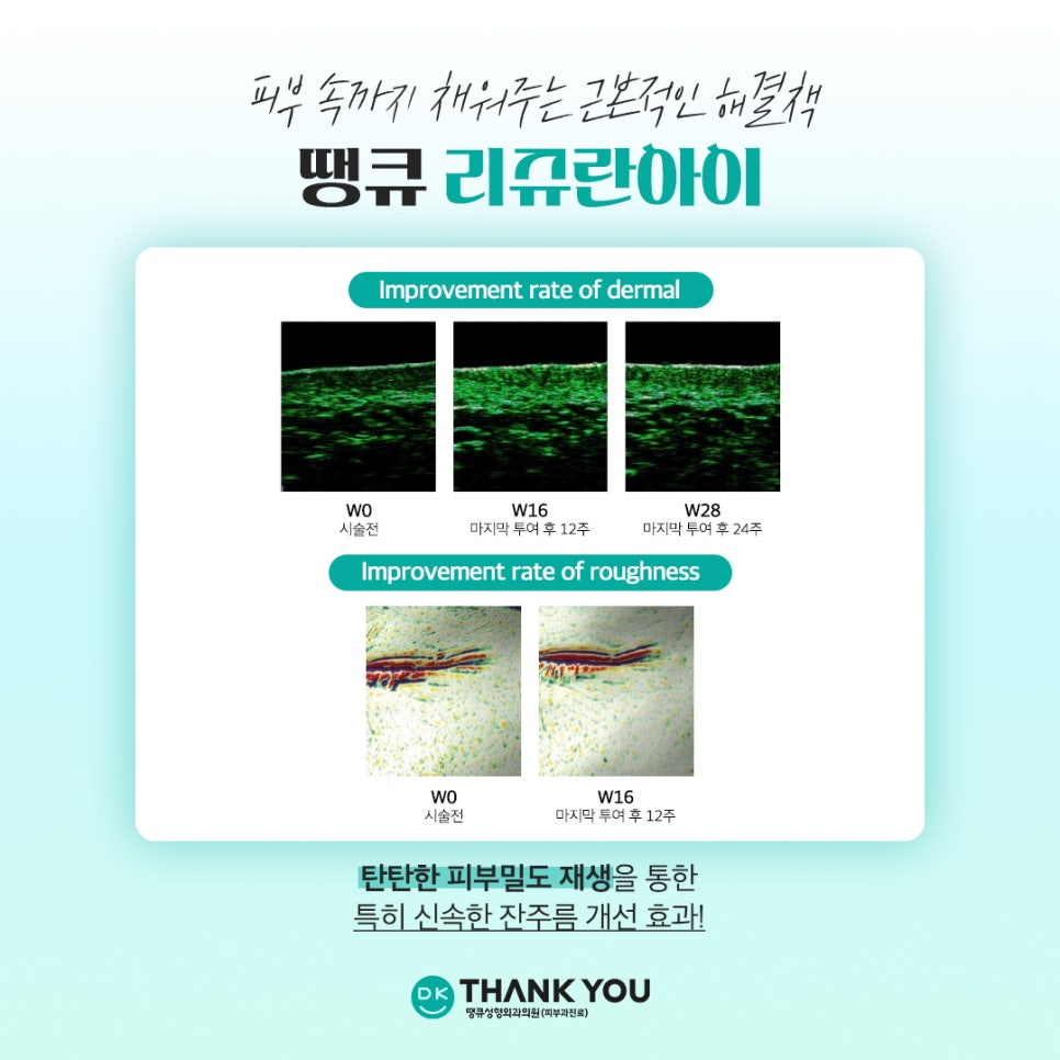 리쥬란아이효과, 눈가 주름과 탄력 두 마리 토끼를 잡고 싶다면 관련 이미지 4