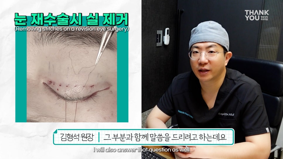 눈꺼풀에 딱딱한 여드름? 육아종 제거 [비절개] 관련 이미지 10