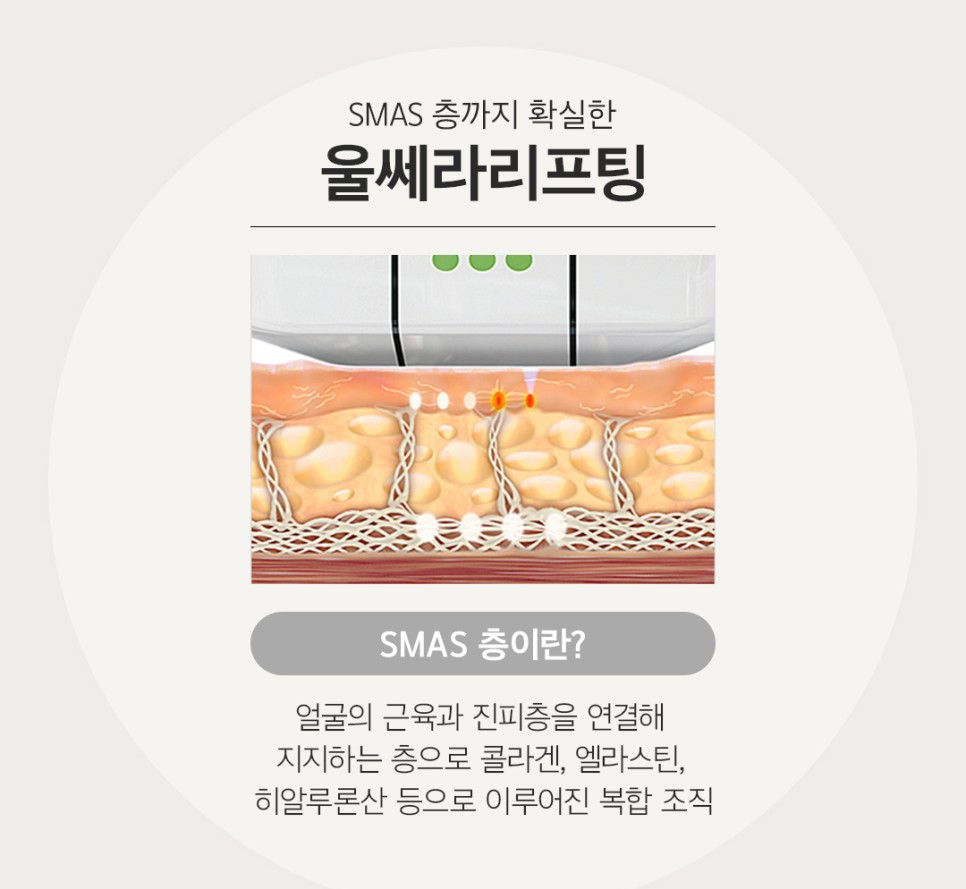 울쎄라 주기는? 지속기간? 울쎄라vs슈링크 차이점? 관련 이미지 3