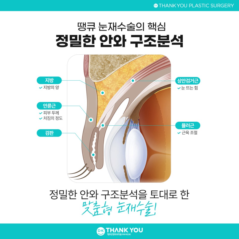 눈재수술병원 잘 고르려면?! 맞춤 수술 여부가 핵심👍 관련 이미지 7