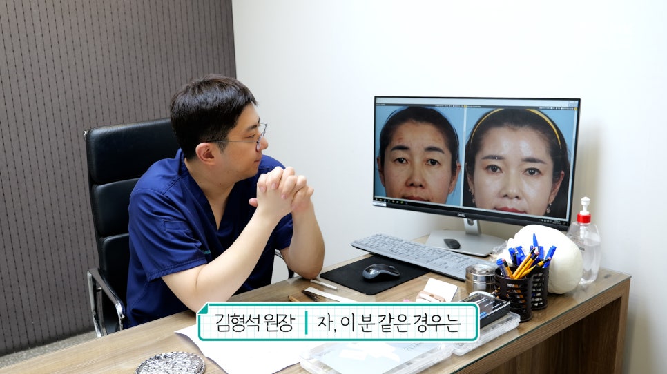 중년눈성형 전후& 이마거상+눈썹하거상+쌍수로 젊어지기 관련 이미지 2