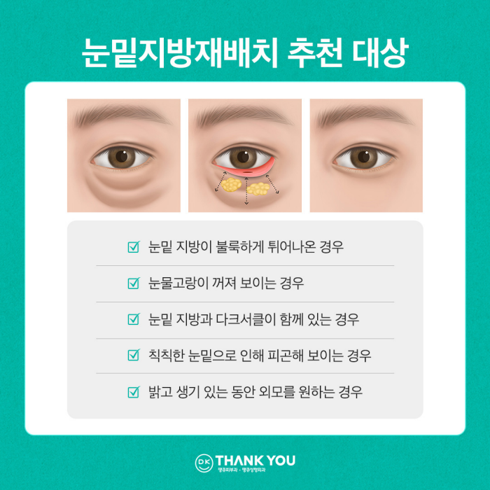 눈밑꺼짐수술? 눈밑지병원에서 내게 딱 맞게! 관련 이미지 6