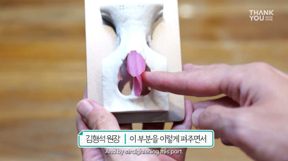 2분만에 막힌 코 뻥 뚫어주는 코블레이션 [ft.비염코성형 전후] 관련 이미지 9