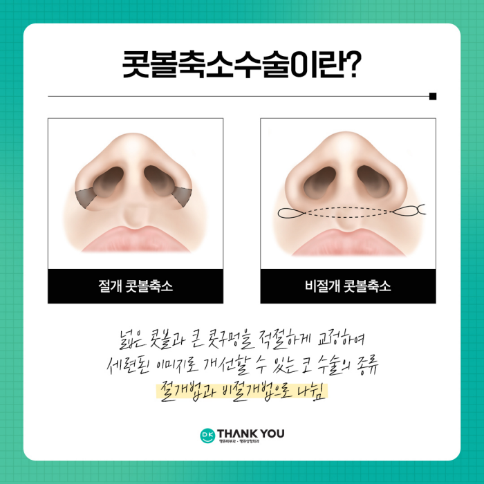 콧볼축소술로 촌스러운 이미지 만드는 콧볼줄이기! 관련 이미지 3