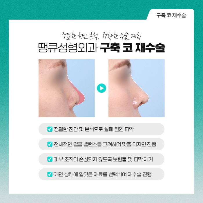 구축코재수술 개인 상태에 따른 계획이 중요해요 관련 이미지 5