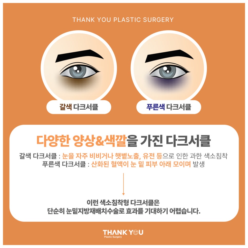 다크서클 눈밑지방재배치 수술로 개선될까? 관련 이미지 5