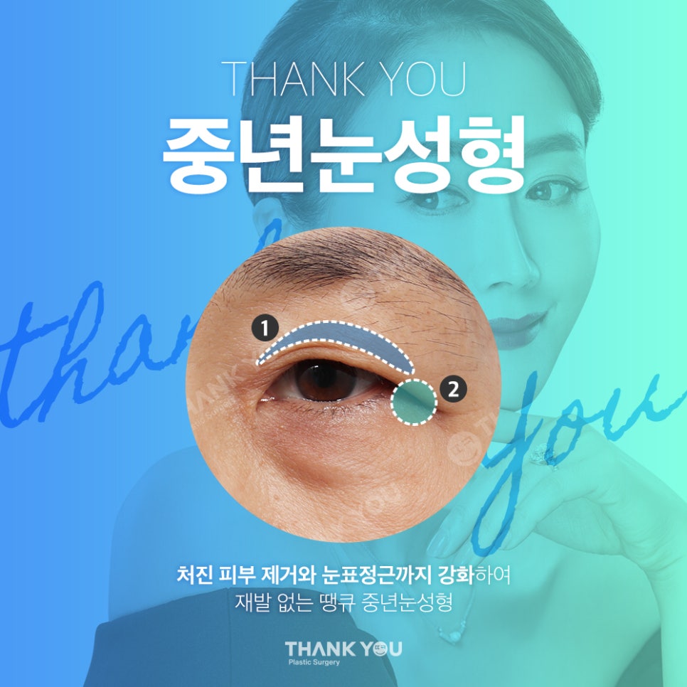 중년눈수술, 50대 60대 눈처짐과 눈꺼풀짓무름 해결법 관련 이미지 4