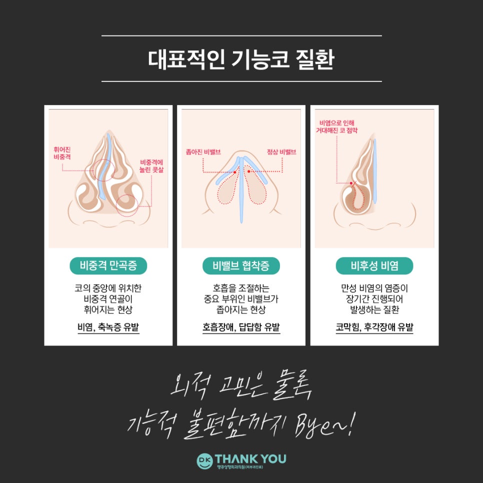 첫코성형 EVENT! 땡큐에서 자연스러운 콧대~코끝 라인 완성! 관련 이미지 11