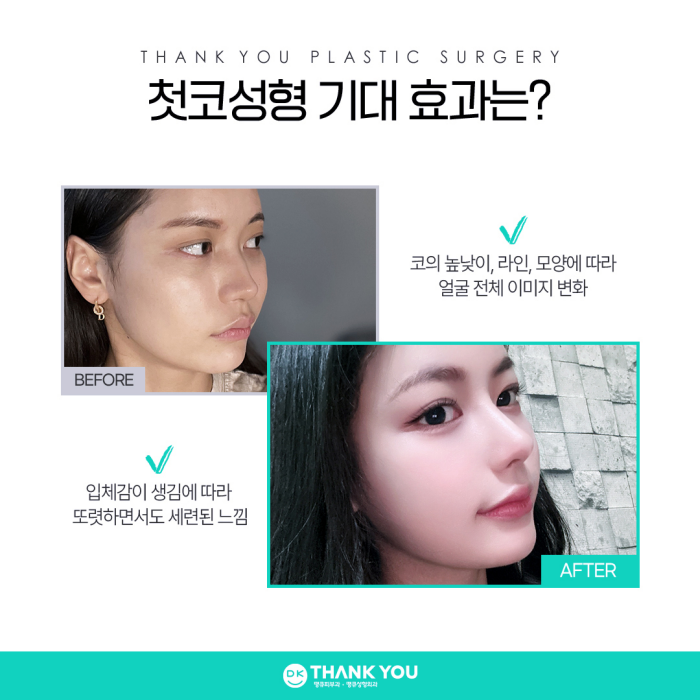 첫코성형은 코수술잘하는곳에서, 내게 딱 맞게! 관련 이미지 2