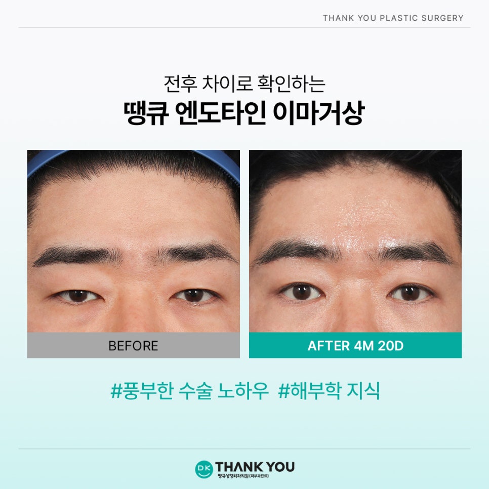 엔도타인 비용? 이마거상 시 정품 여부부터 체크!⭐️ 관련 이미지 9