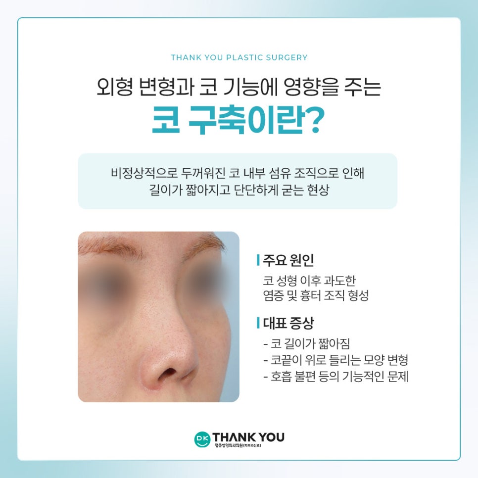 What Does a Contracted Nose Mean, and How Is Revision Surgery Performed? ❓Why Stem Cell Treatment Is Gaining Attention image 2