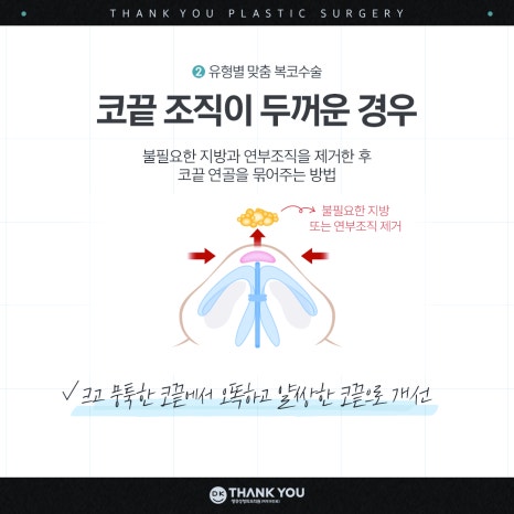 A Great Bulbous Nose Surgery Review: Making a Slim Nose at Thank You! image 6