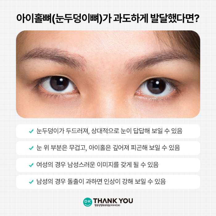 눈매개선, 눈성형으로 해결되지 않는다면?! 눈의 틀을 개선하는 아이홀쉐이빙 관련 이미지 2