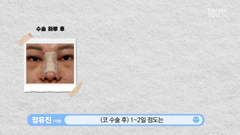 뚱뚱한 코 탈출! 실리콘 코성형👃(직원 코성형 브이로그2탄) 관련 이미지 10