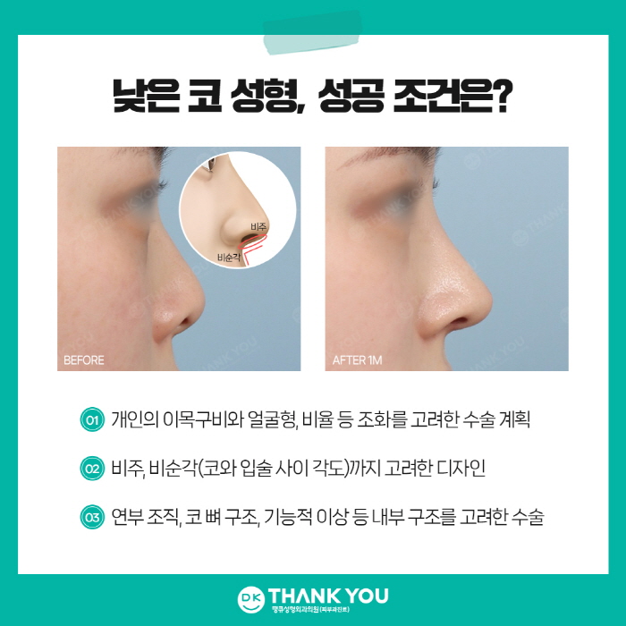 낮은코성형, 완성도 높은 결과를 얻고 싶다면 주목! 관련 이미지 4