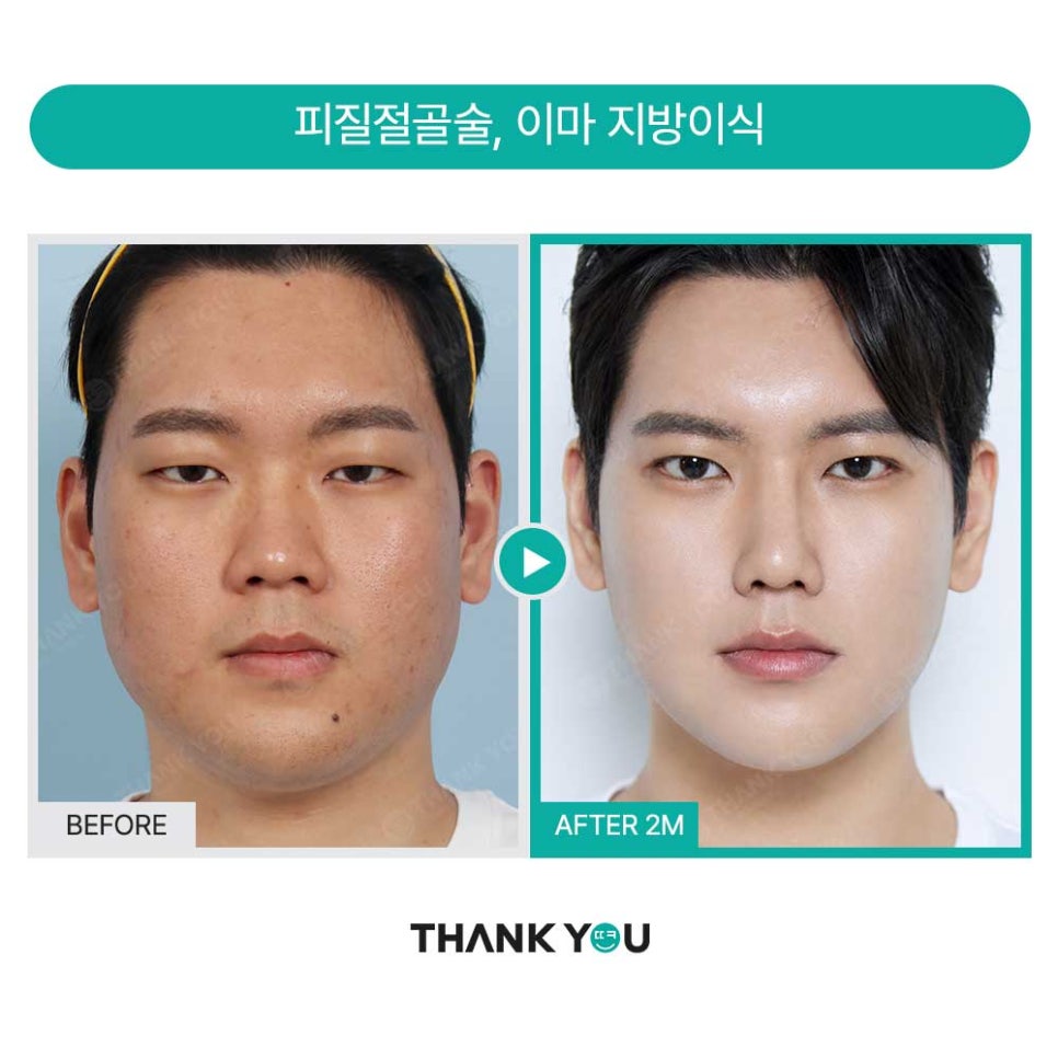 의벤져스 땡큐, 관련 이미지 10