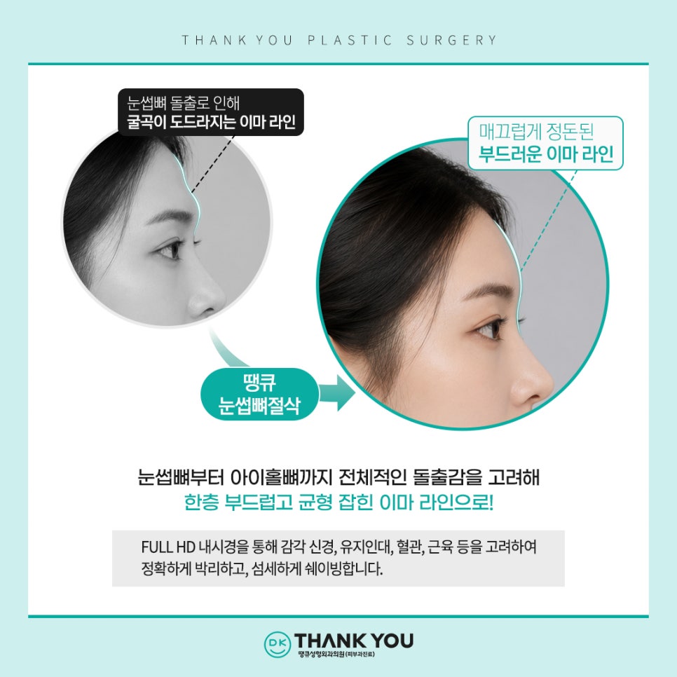 이마거상 흉터, 탈모 걱정된다면? 내시경이마거상술 총정리 관련 이미지 13
